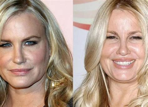 jennifer coolidge before plastic surgery|Plastic Surgery & Dermatology 